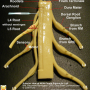 Lumbar Disc Herniation Model