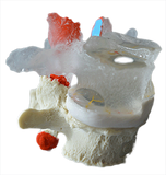 Lumbar Model - Hybrid Split