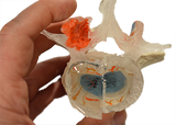 Lumbar Model - Hybrid Split