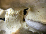 Stenosis Model