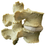 Stenosis Model